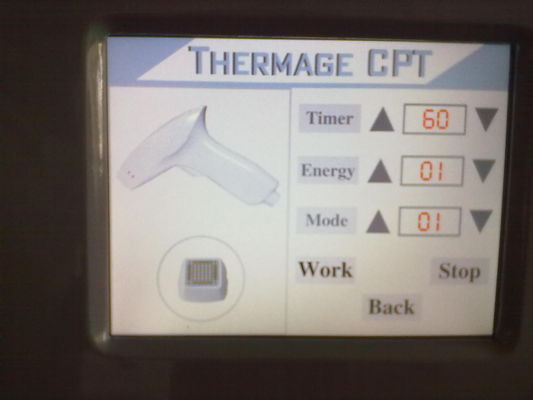 Thermage Radio frequency Skin Rejuvenation Machine To Skin Tightening