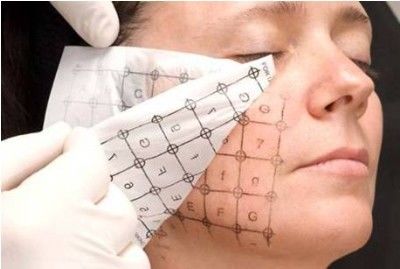 Thermage Radio frequency Skin Rejuvenation Machine To Skin Tightening