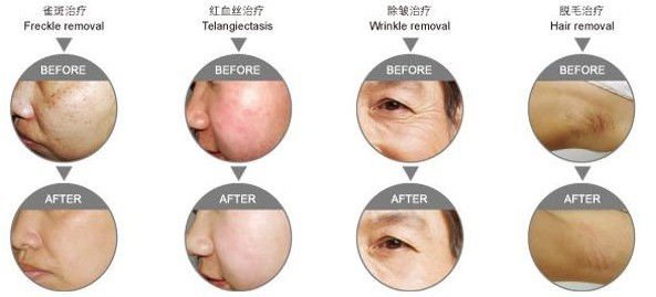 Facotry 가격 2013 가장 새로운 ipl 기계