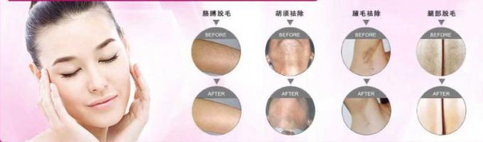 Facotry 가격 2013 가장 새로운 ipl 기계